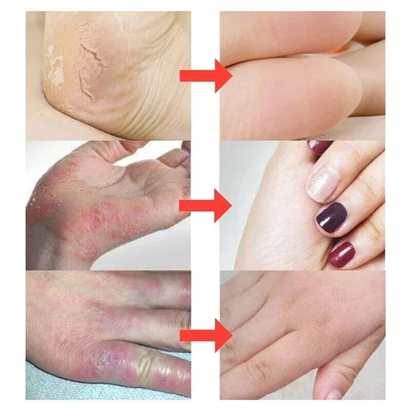 Traditional Classic Clam Oil Cracked Repair Cream Anti-drying Removal Dead Skin Hand Feet Foot Care Ointment Moisturize Care Oil