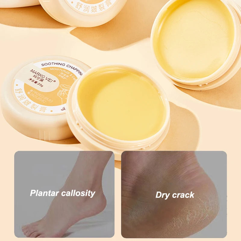 Callus remover cream for heels and feet, shown in packaging with labels for plantar callosity and dry cracks.