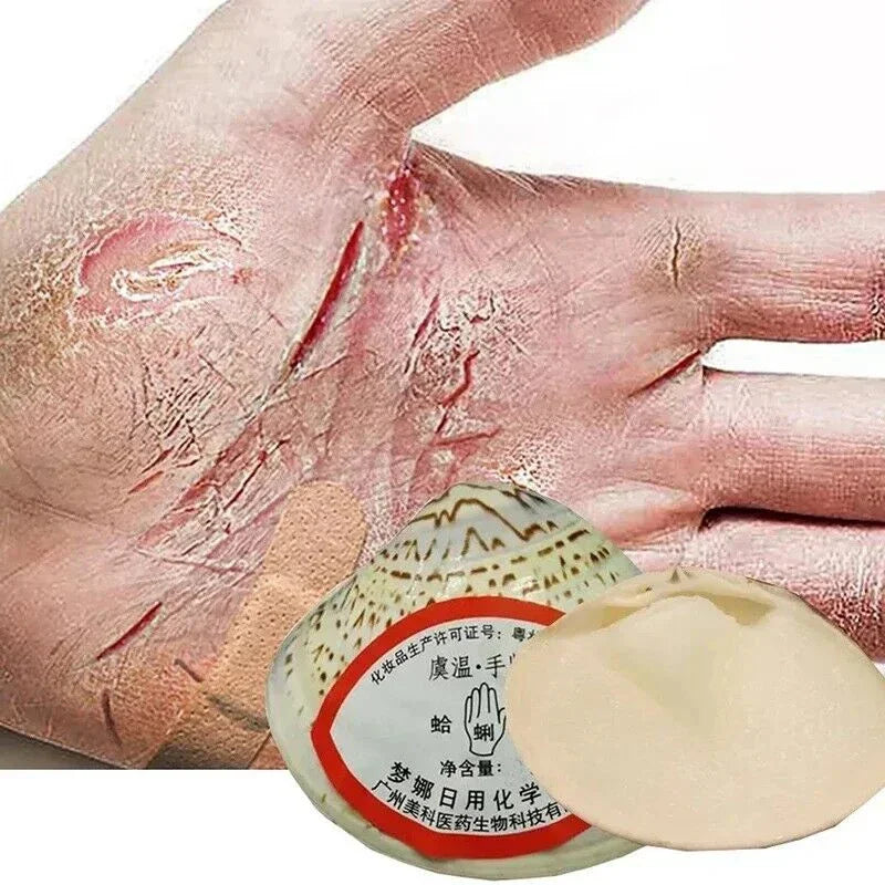 Traditional Classic Clam Oil Cracked Repair Cream Anti-drying Removal Dead Skin Hand Feet Foot Care Ointment Moisturize Care Oil
