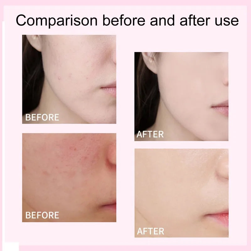 Before and after comparison of skin using CC Foundation Cream showing improved blemish coverage and brighter complexion.