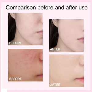Before and after comparison of skin using CC Foundation Cream showing improved blemish coverage and brighter complexion.