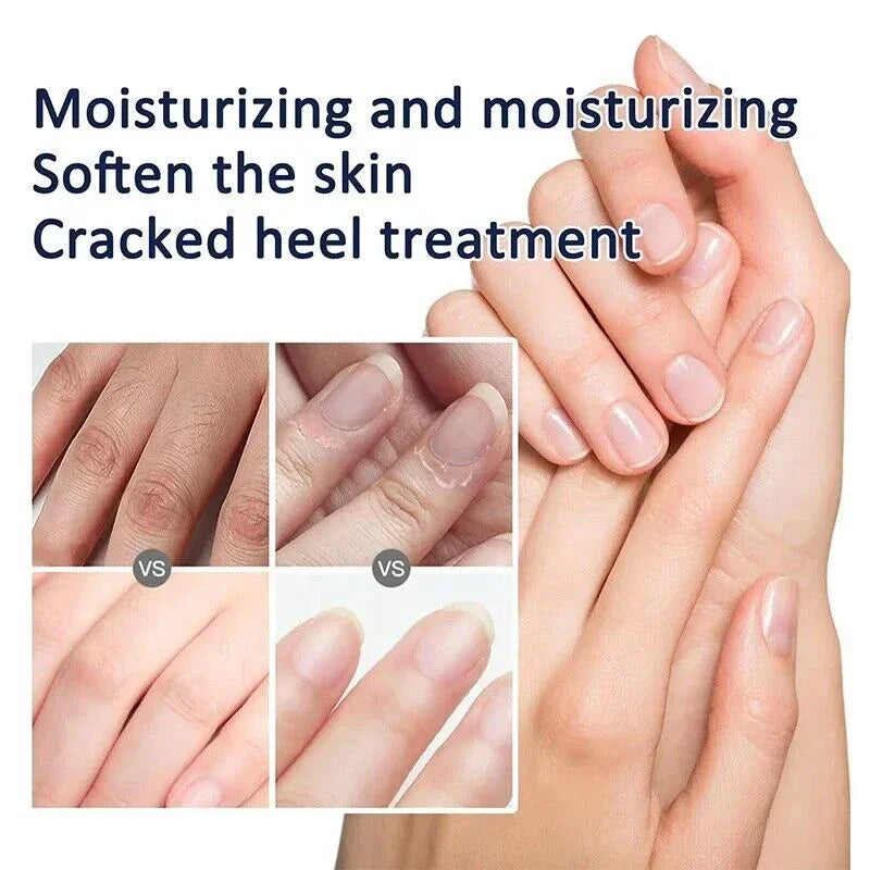 Traditional Classic Clam Oil Cracked Repair Cream Anti-drying Removal Dead Skin Hand Feet Foot Care Ointment Moisturize Care Oil