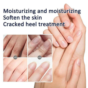 Traditional Classic Clam Oil Cracked Repair Cream Anti-drying Removal Dead Skin Hand Feet Foot Care Ointment Moisturize Care Oil