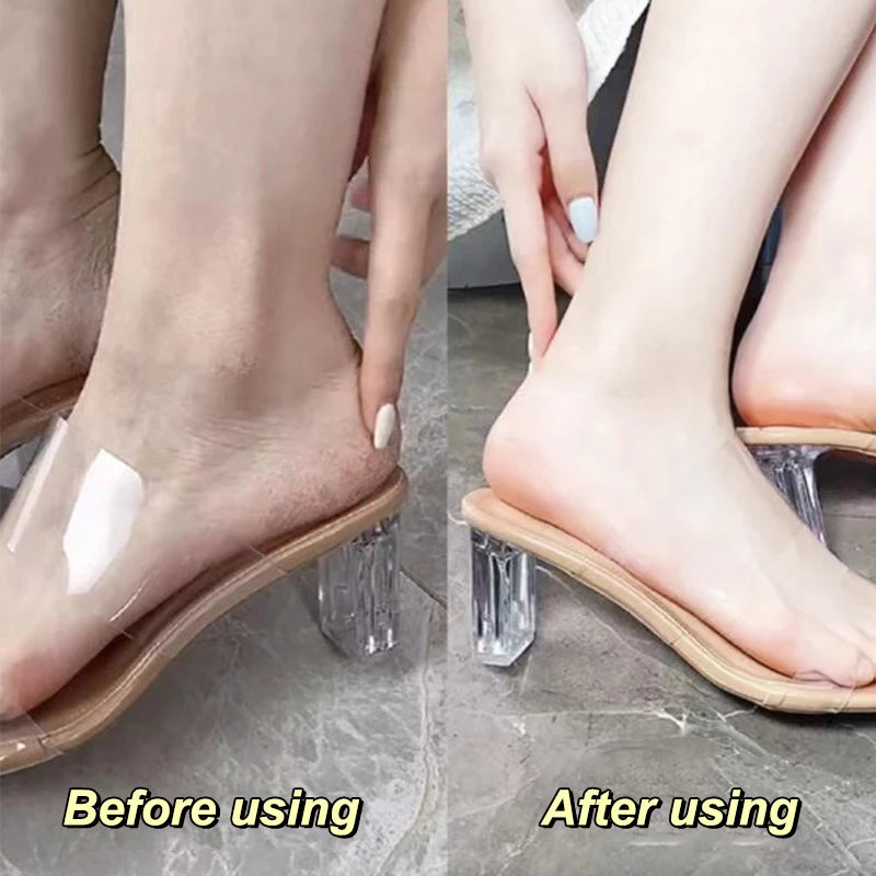 Comparison of foot appearance before and after using callus remover cream, showing improved softness and smoothness.