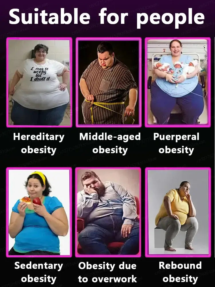 Infographic displaying different types of obesity: hereditary, middle-aged, puerperal, sedentary, work-related, and rebound obesity.