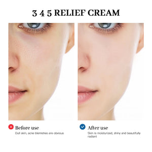 345 Relief Cream Address Blemishes Nourish The Skin and Provide Soothing Care Resulting In A Well-Rounded Skincare Solution