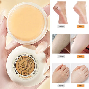 Transform dry skin with KuZHEN intense moisturizing cream for hands and feet. Before and after skin improvement results.