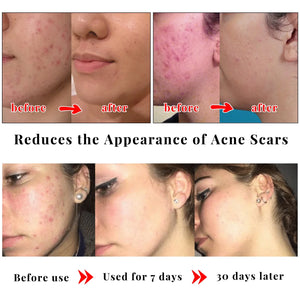 Kojic Acid Soap Kojic Acid Skin Care Set Face Cream Body Lotion Cleanser Skin Whitening Brightening Moisturizing  Anti Aging